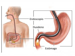Cosa verifica l’endoscopio nel corso della EGDS Cosa verifica l’endoscopio nel corso della EGDS